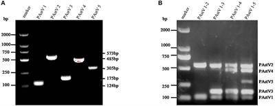 Establishment of a Multiplex RT-PCR Method for the Detection of Five Known Genotypes of Porcine Astroviruses